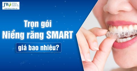 Trọn gói Niềng răng SMART giá bao nhiêu 2024?