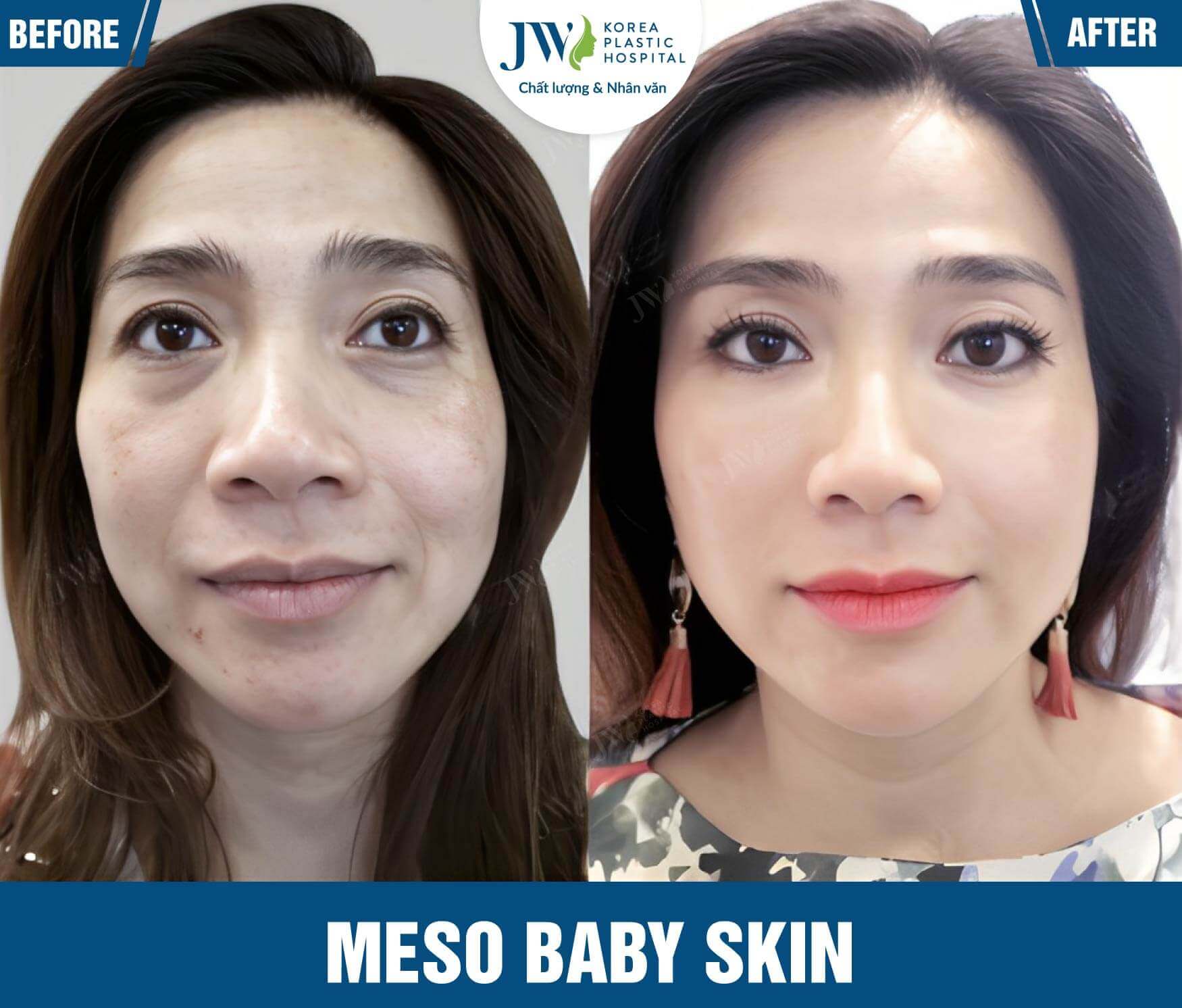 meso baby skin jw