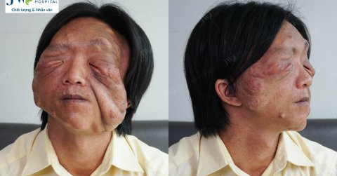 Pu phẫu thuật thẩm mỹ gây sốt với diện mạo mới