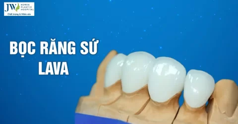 Đẹp hơn, thẩm mỹ hơn cùng dòng răng toàn sứ Lava 3M