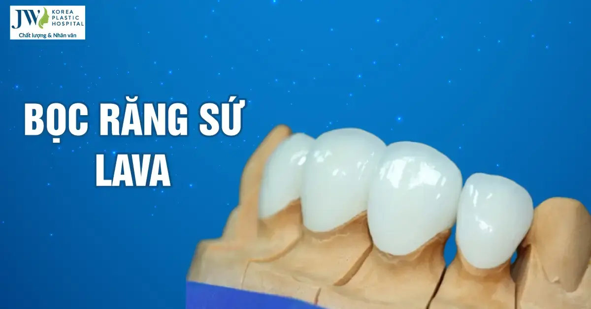 Đẹp hơn, thẩm mỹ hơn cùng dòng răng toàn sứ Lava 3M
