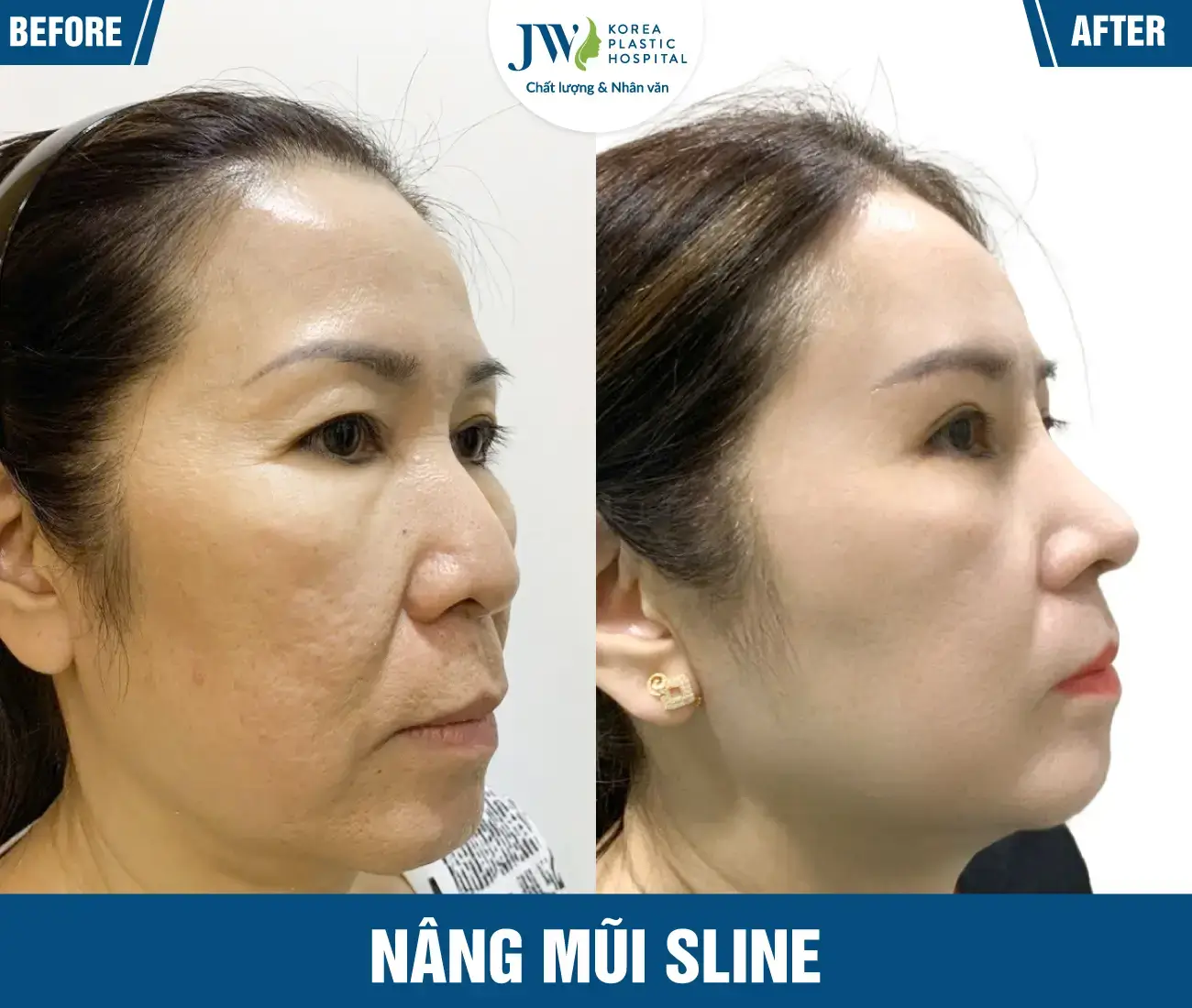 nang-mui-s-line-01-one-25