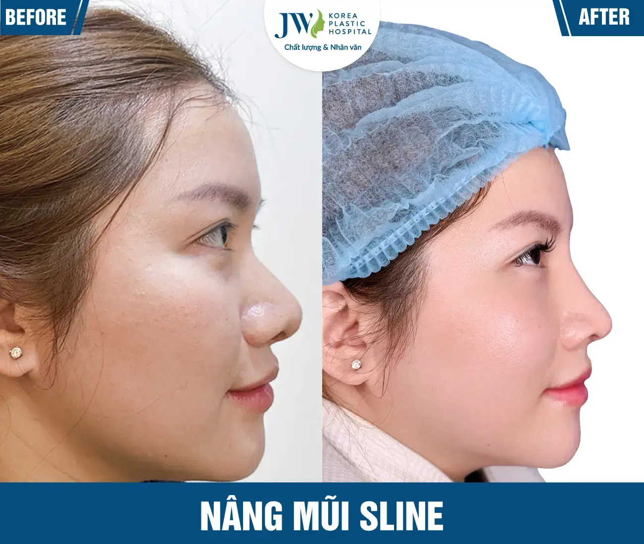 nang-mui-s-line-02-two-25