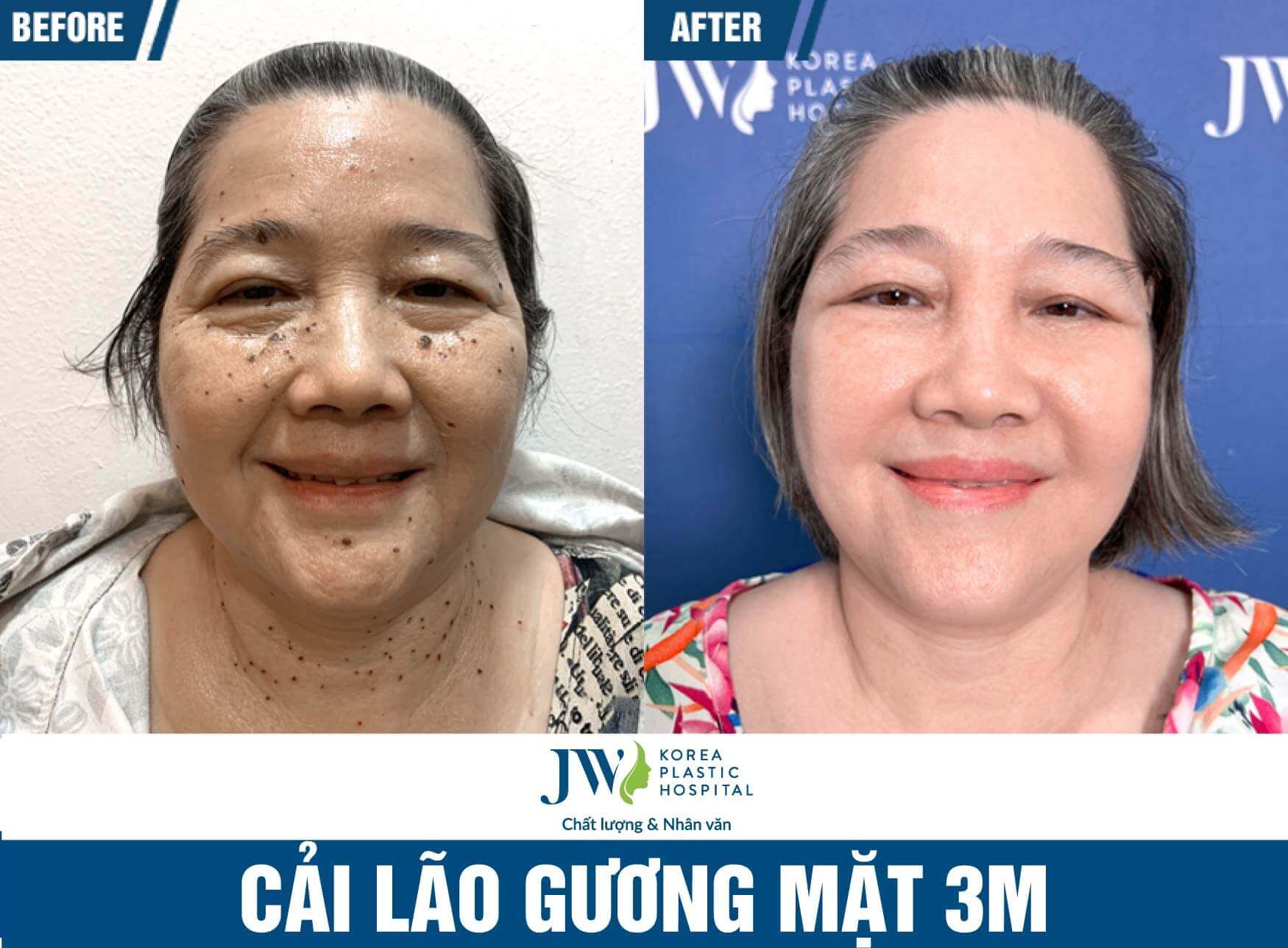 cai lao guong mat 3m