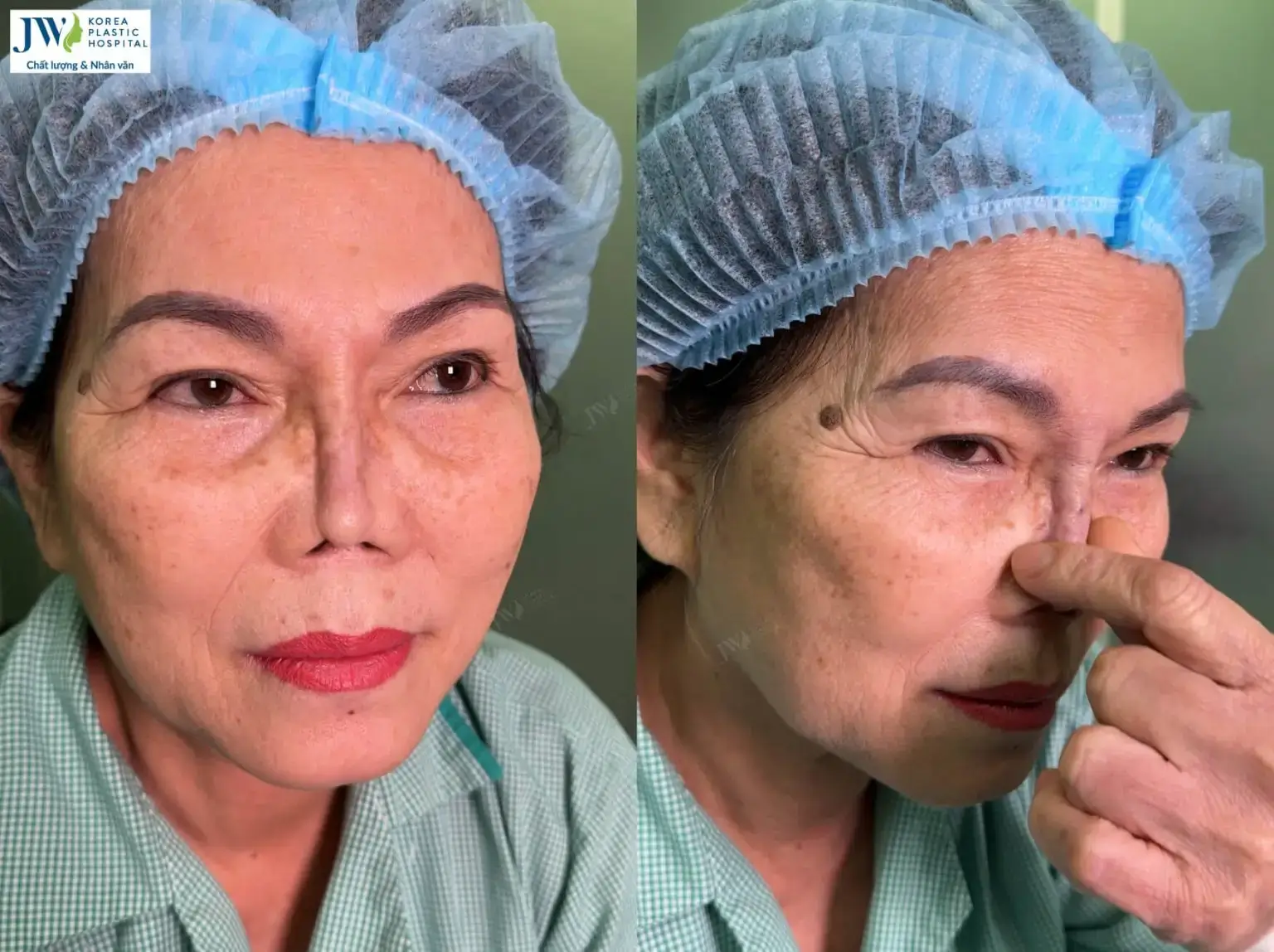 mui-bien-chung-co-rut-1536x1148