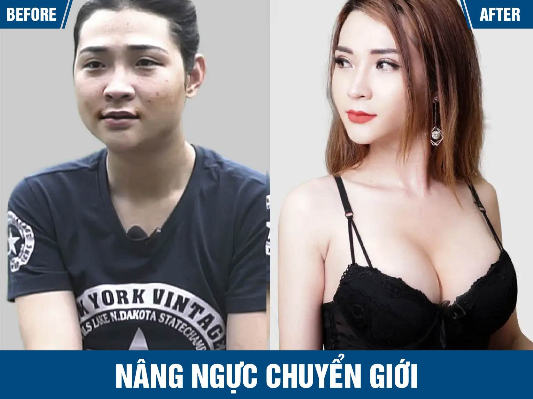 nang nguc chuyen gioi