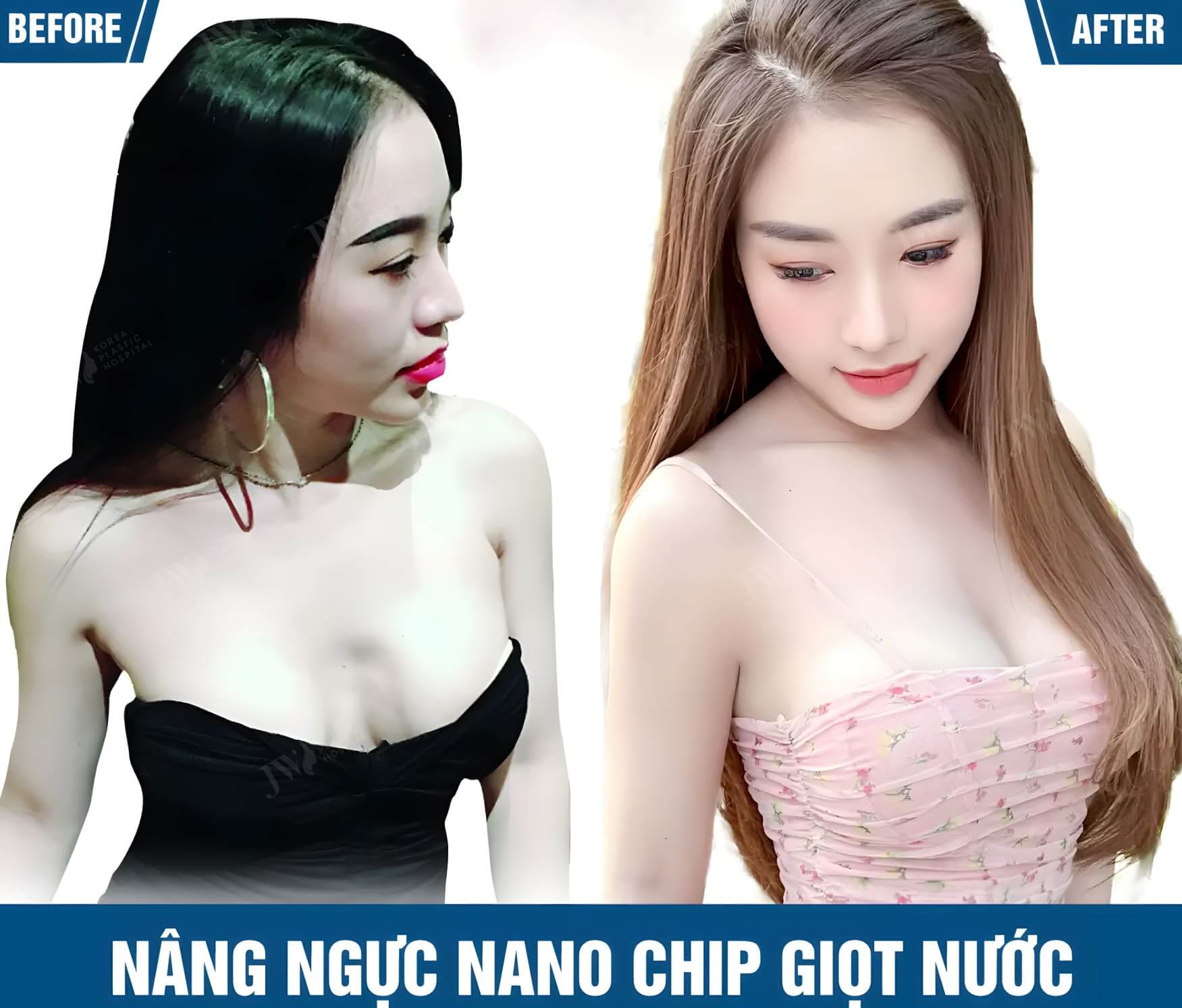 nang nguc nano chip