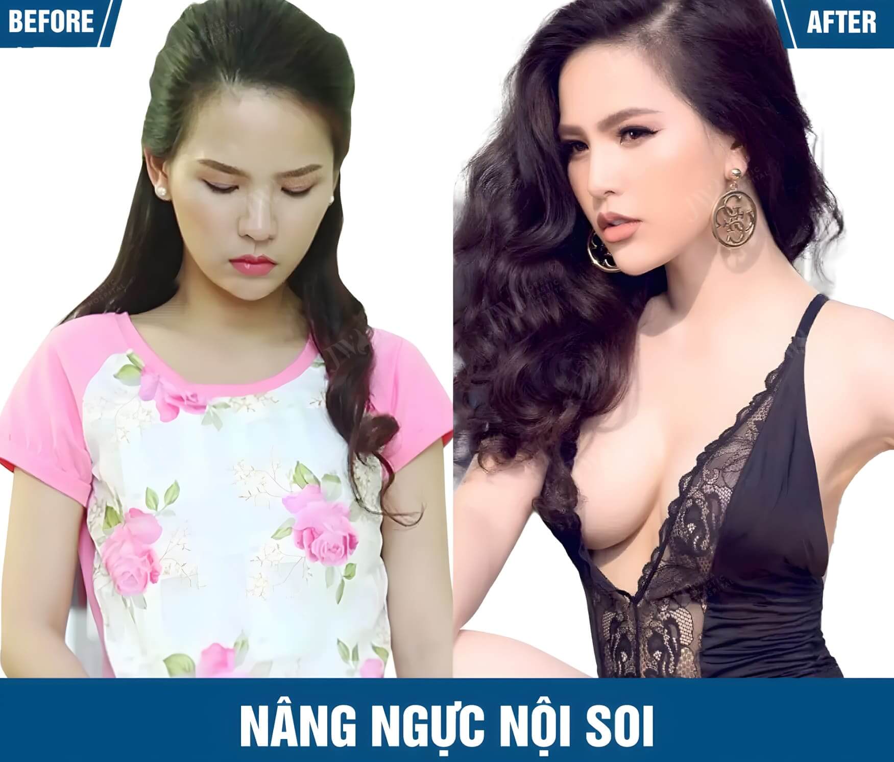 nang nguc noi soi