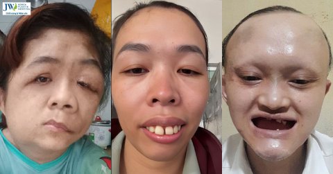 Cảm động hoàn cảnh Nhan sắc mới – Khởi đầu mới mắc bệnh lạ