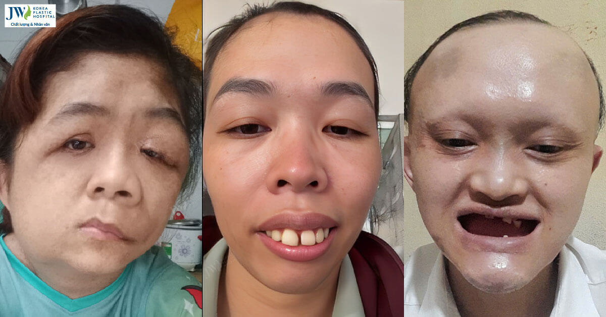 Cảm động hoàn cảnh Nhan sắc mới – Khởi đầu mới mắc bệnh lạ