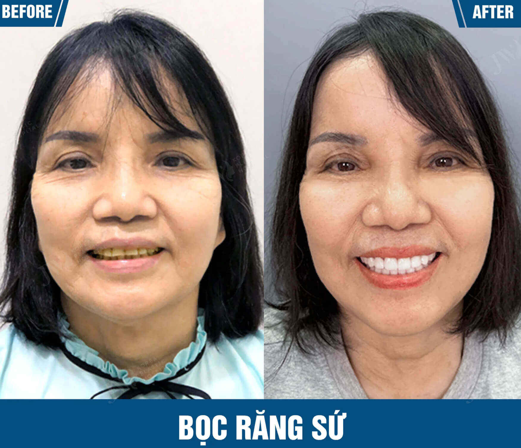 boc rang su