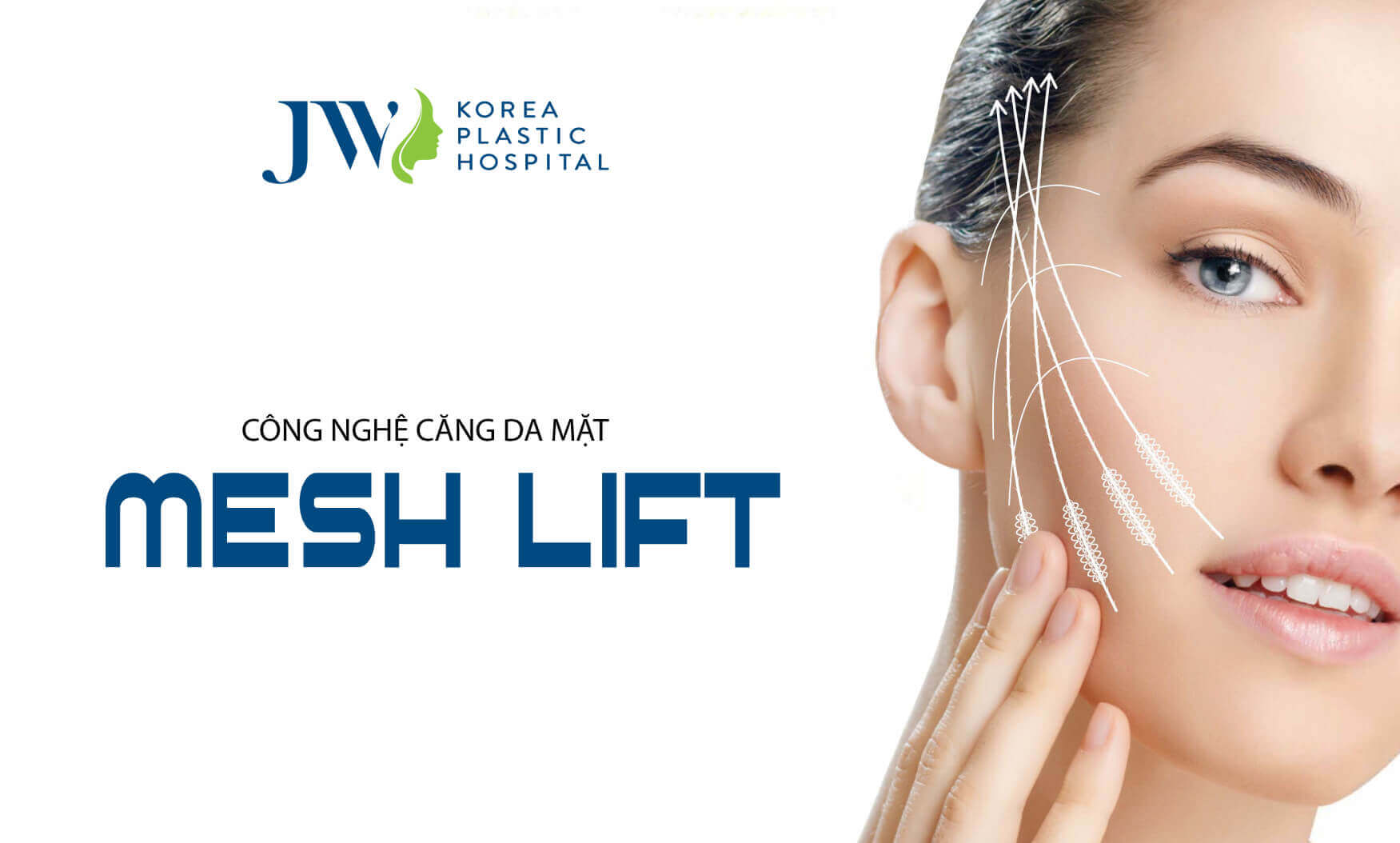 cang-chi-mesh-lift