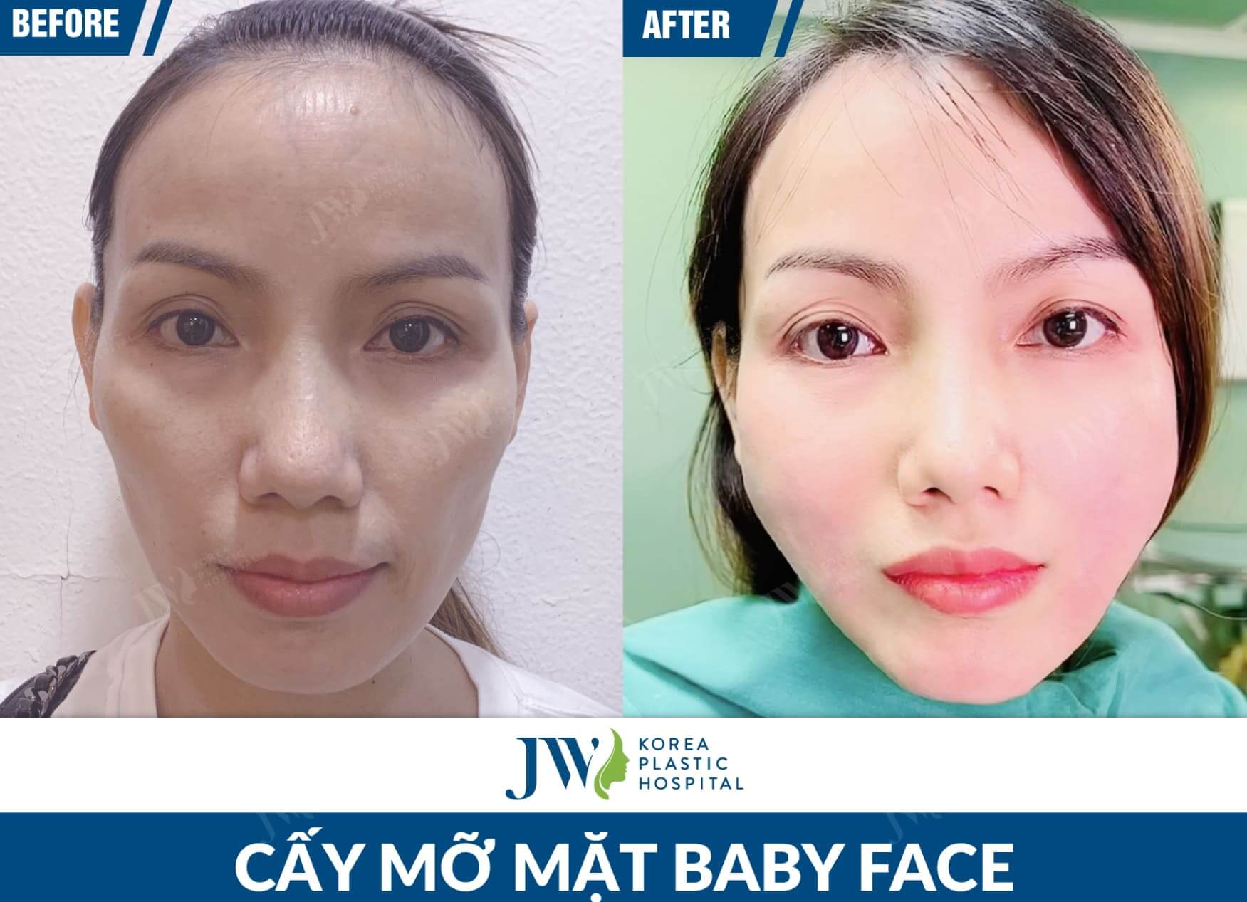 cay mo mat baby face