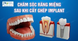 chăm sóc răng miệng