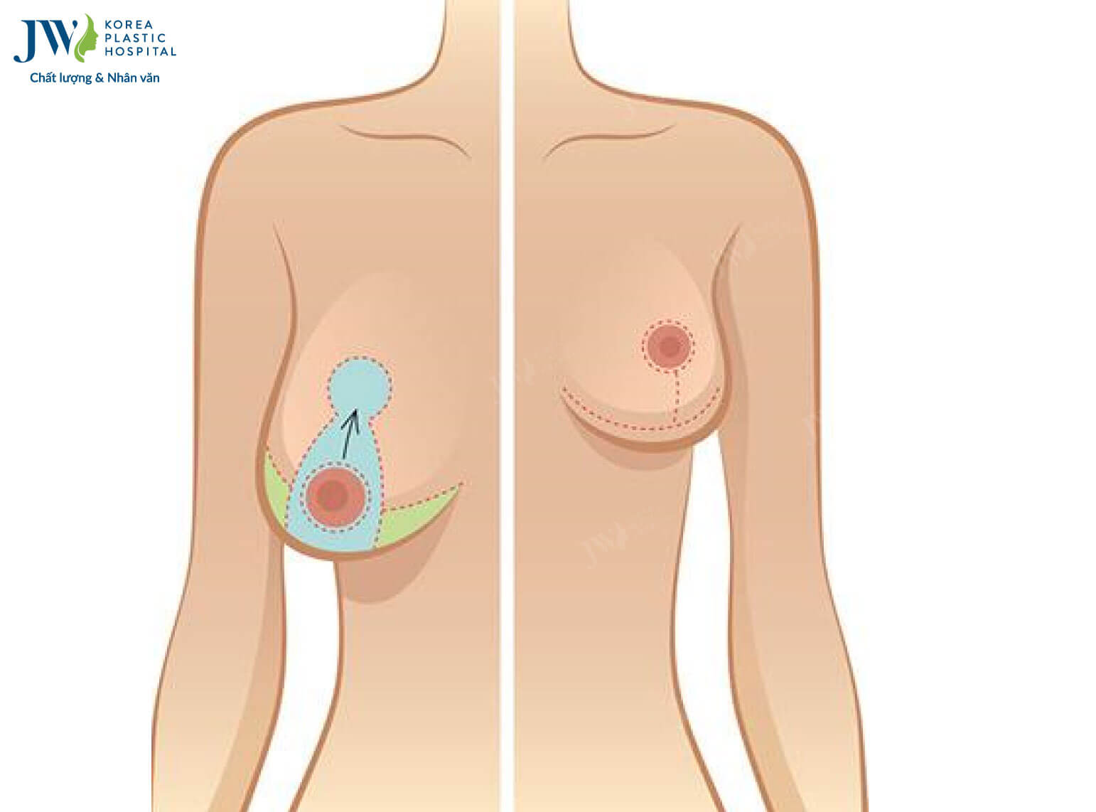 doi-tuong-nen-nang-nguc-chay-xe