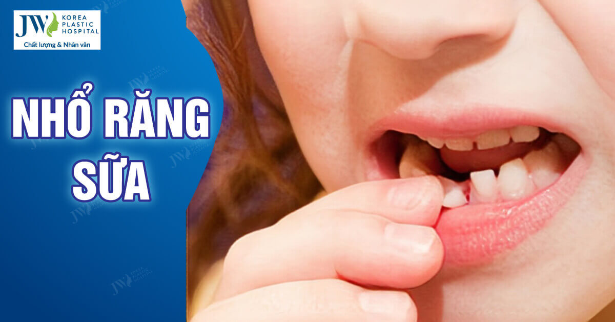 Khi nào nên nhổ răng sữa cho trẻ và những lưu ý cần thiết