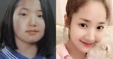 10+gái xinh vướng tin thay đổi ngoại hình nhờ phẫu thuật thẩm mỹ
