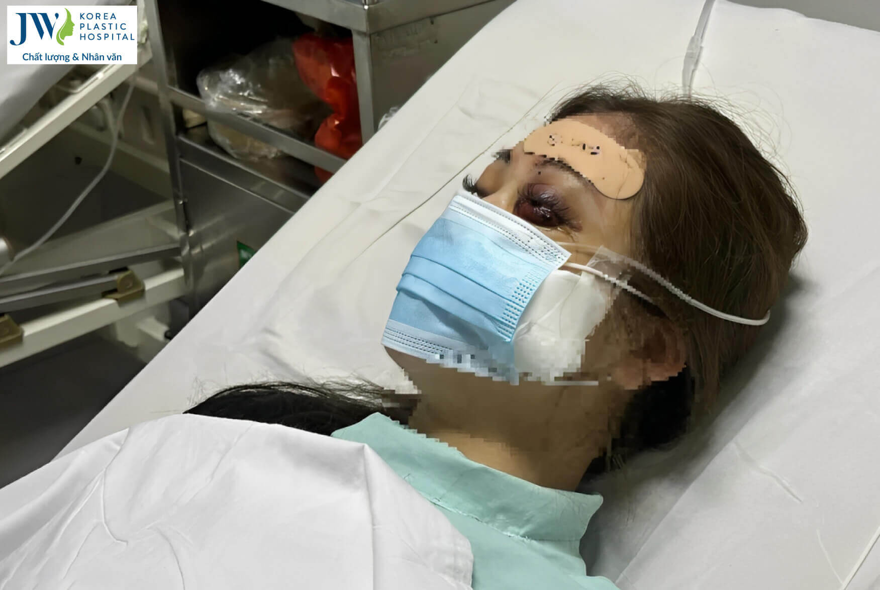 tiem-filler-nang-mui-tai-nha