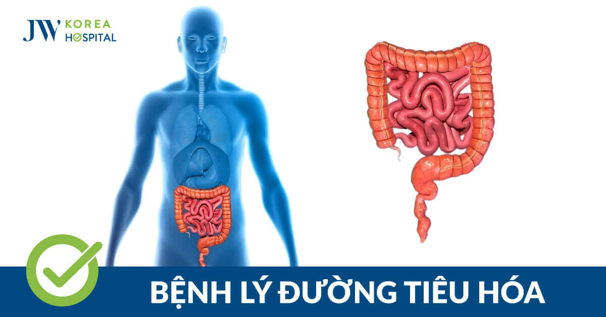 Giải pháp điều trị đường tiêu hóa an toàn tại Bệnh viện JW