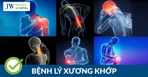 9 căn bệnh xương khớp phổ biến hiện nay đối với mọi lứa tuổi 