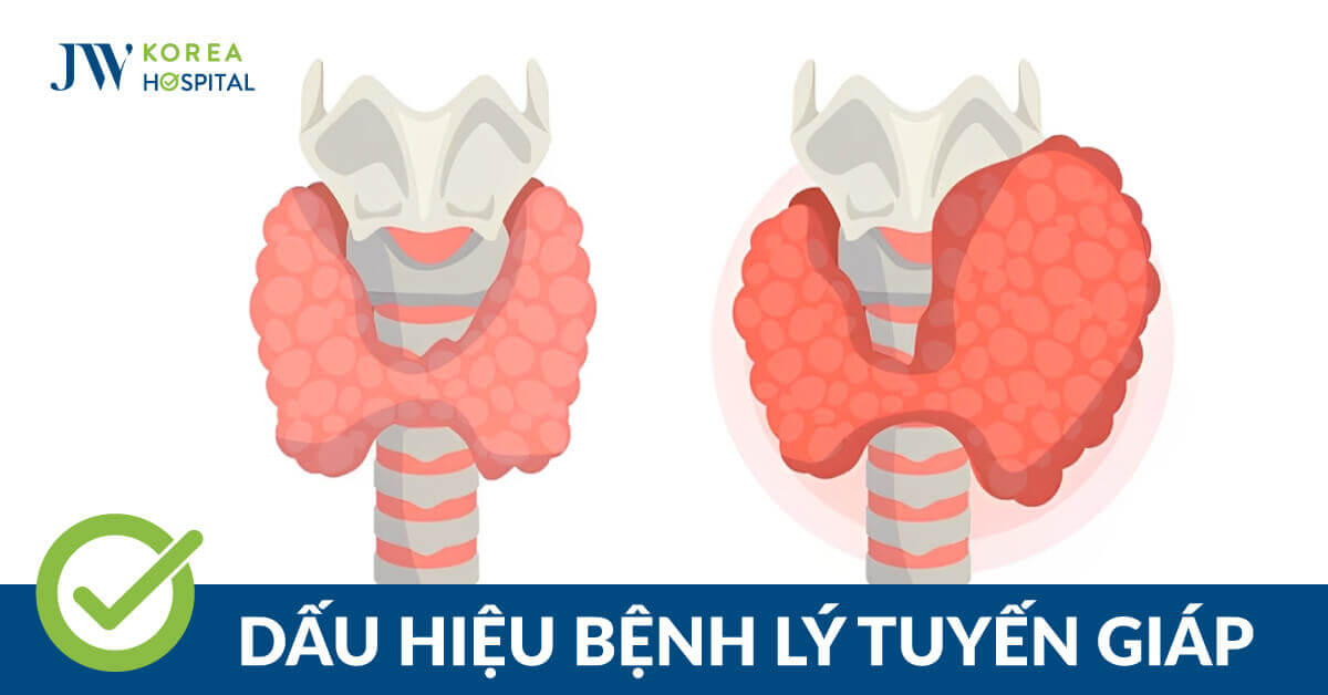 Bệnh lý tuyến giáp: Phát hiện sớm và điều trị chuyên sâu tại JW