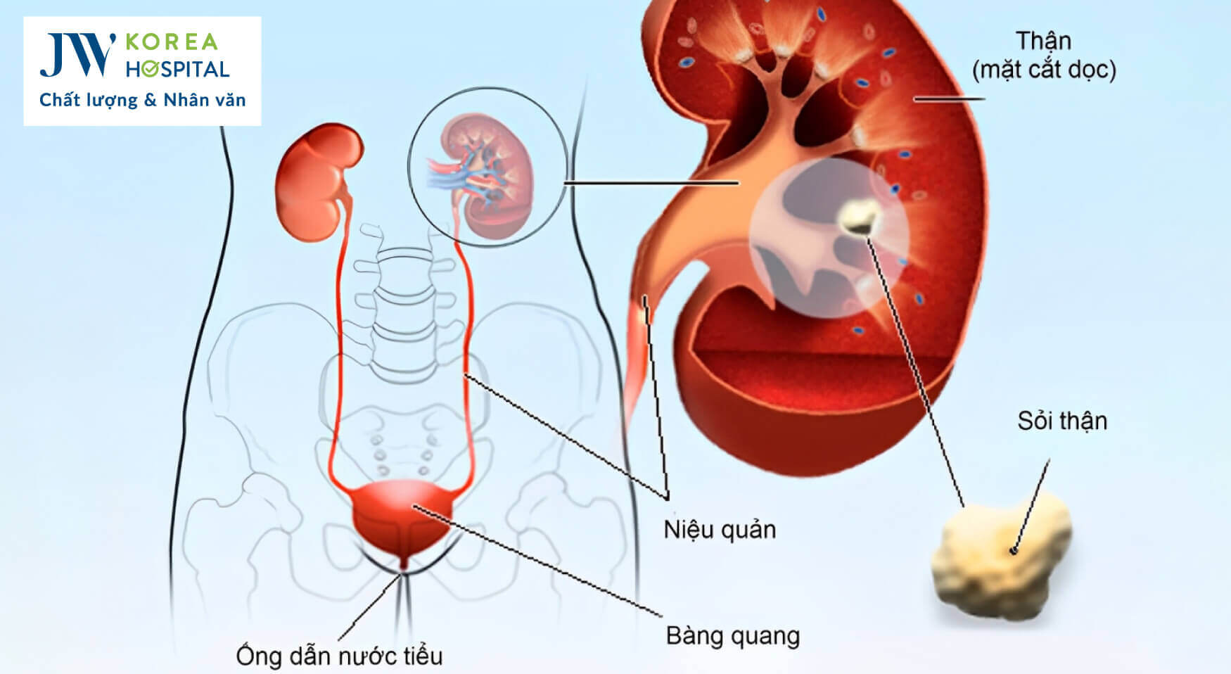 dau-hieu-soi-than