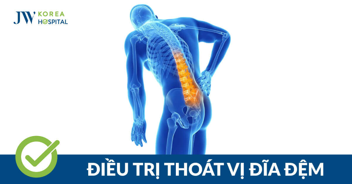 Điều trị thoát vị đĩa đệm hiệu quả tại Bệnh viện JW