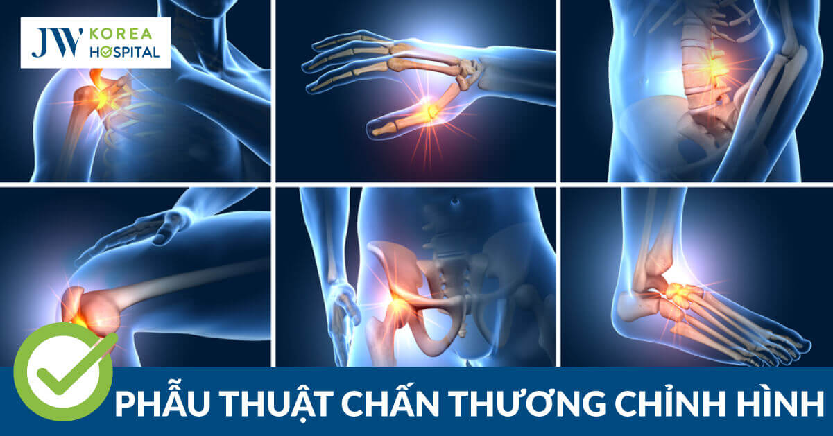 Điều trị chấn thương chỉnh hình an toàn tại Bệnh viện JW