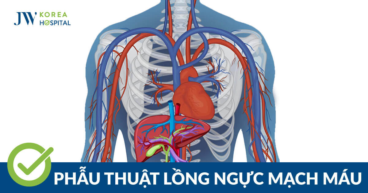 Phẫu thuật lồng ngực mạch máu an toàn tại Bệnh viện JW