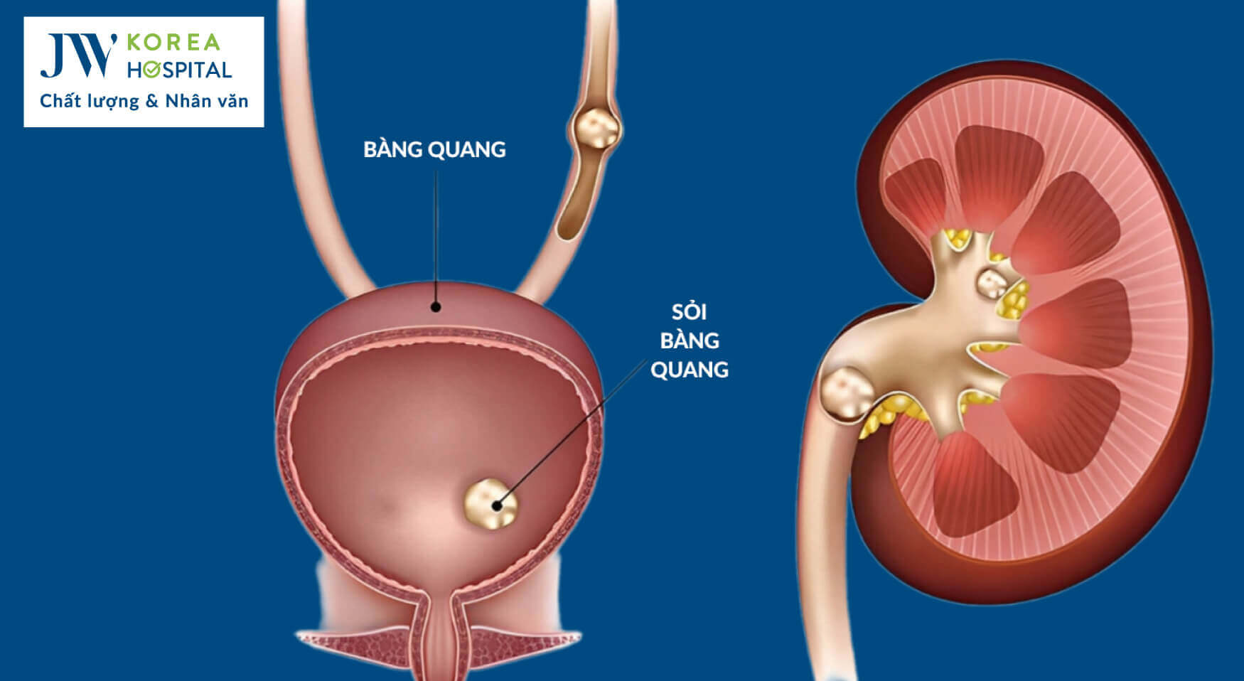 soi-bang-quang