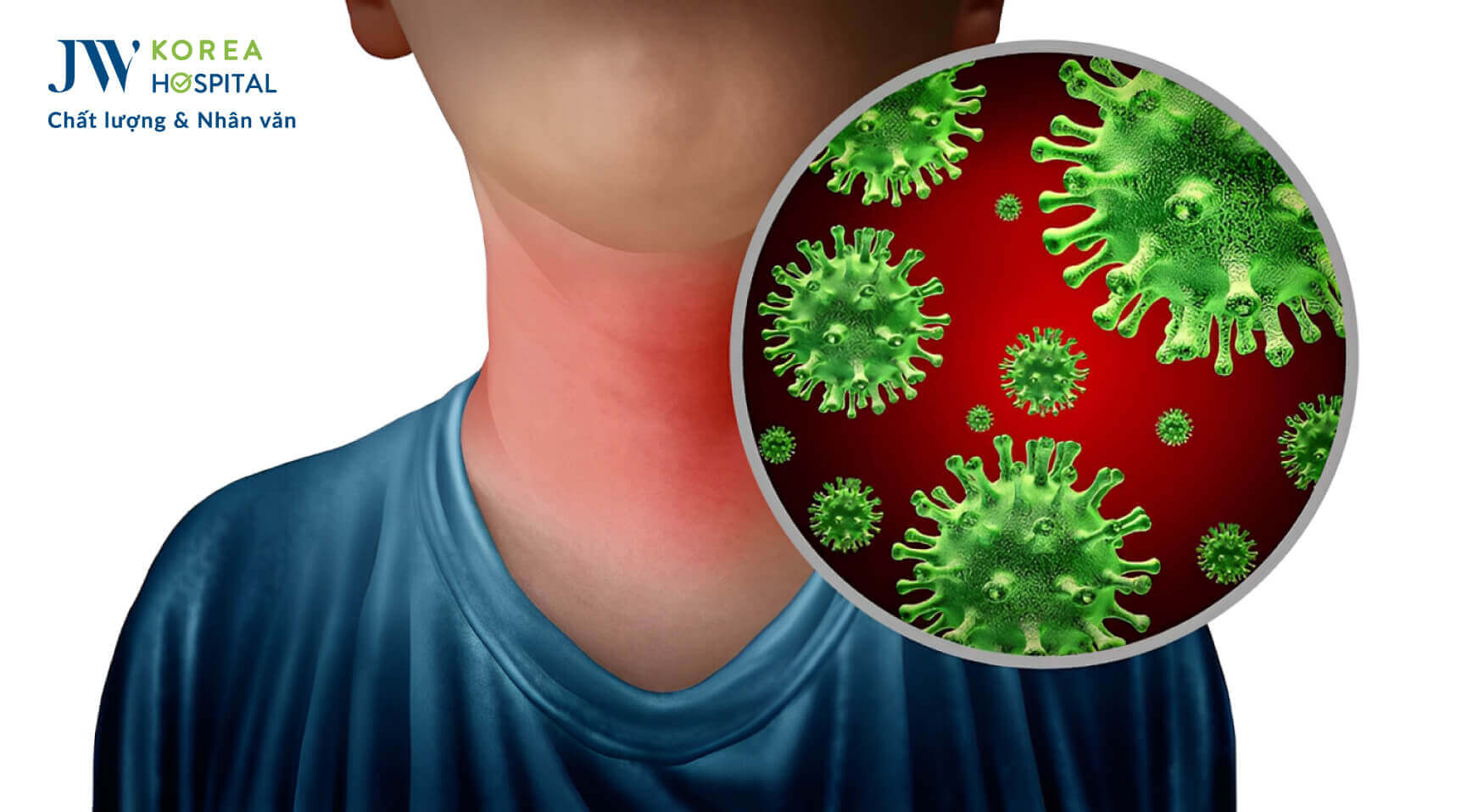 vi-khuan-gay-dau-hong