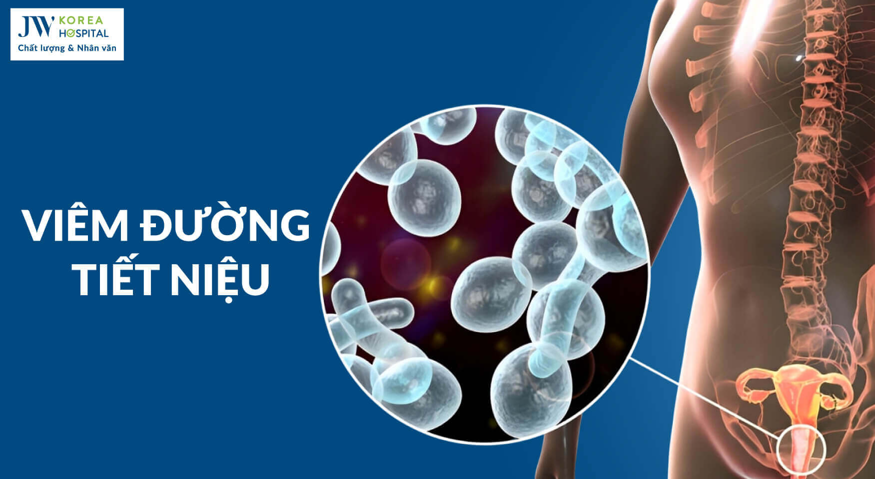 viem-duong-tiet-nieu