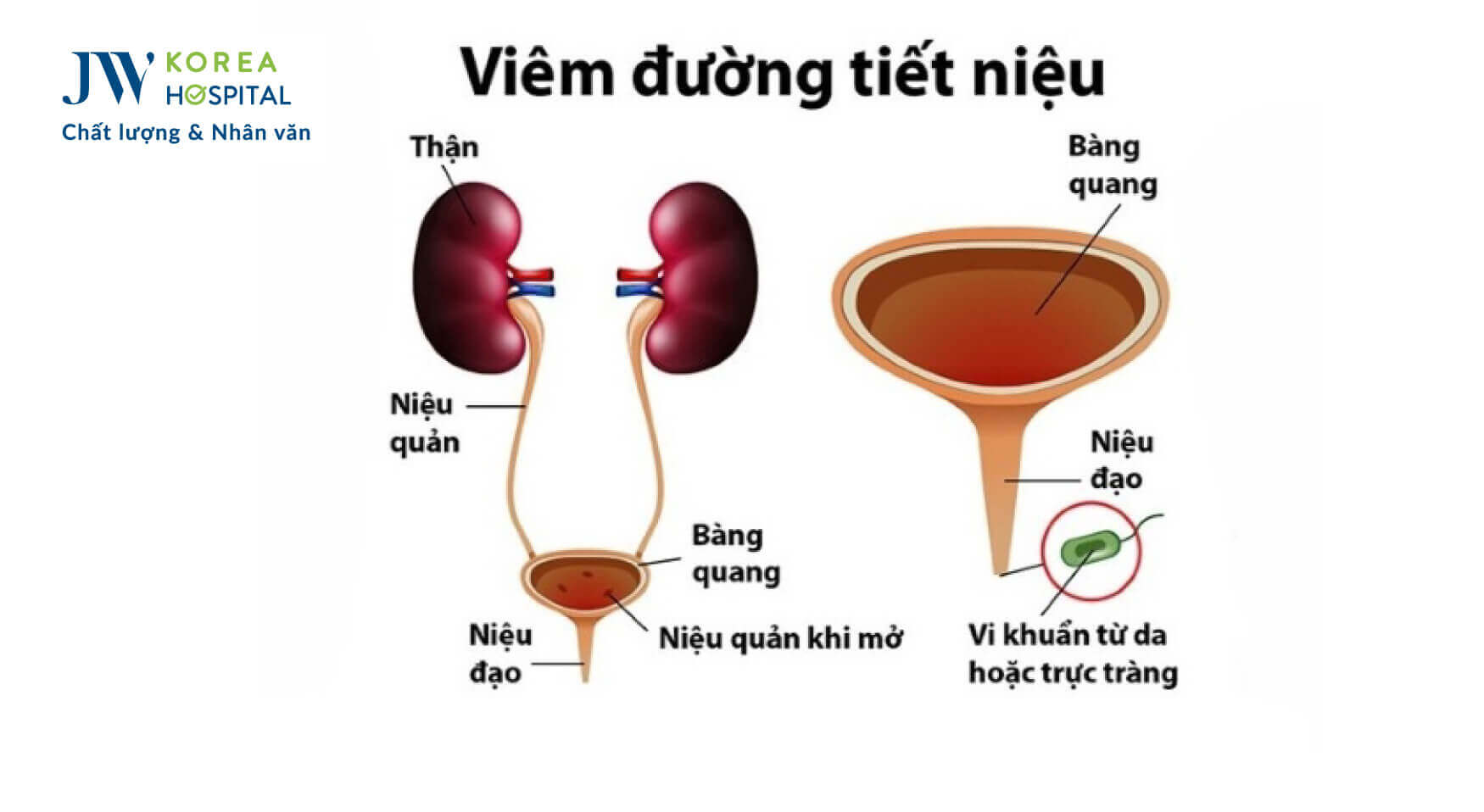 viem-duong-tiet-nieu