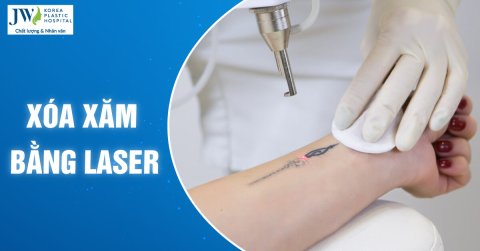 Xóa xăm và những lưu ý bạn cần biết trước khi thực hiện 