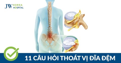 11+ Câu hỏi thường gặp về bệnh lý thoát vị đĩa đệm 