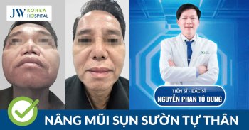Bác sĩ Tú Dung Tỏa Sáng tại VSAPS 2025 với Nâng Mũi Sụn Sườn Tự Thân 