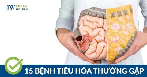 15 Thắc Mắc Phổ Biến về Bệnh Tiêu Hóa và Giải Đáp Chi Tiết