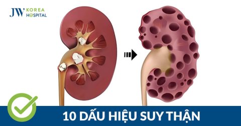 10 dấu hiệu cảnh báo bệnh suy thận sớm nhất 