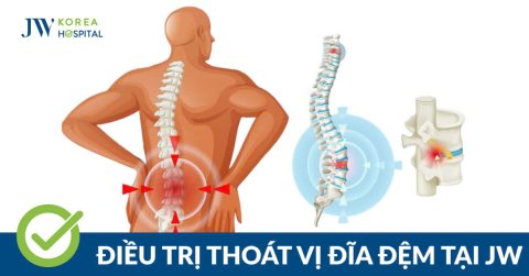 Điều trị thoát vị đĩa đệm tại JW: Chính xác từ chẩn đoán đến hồi phục