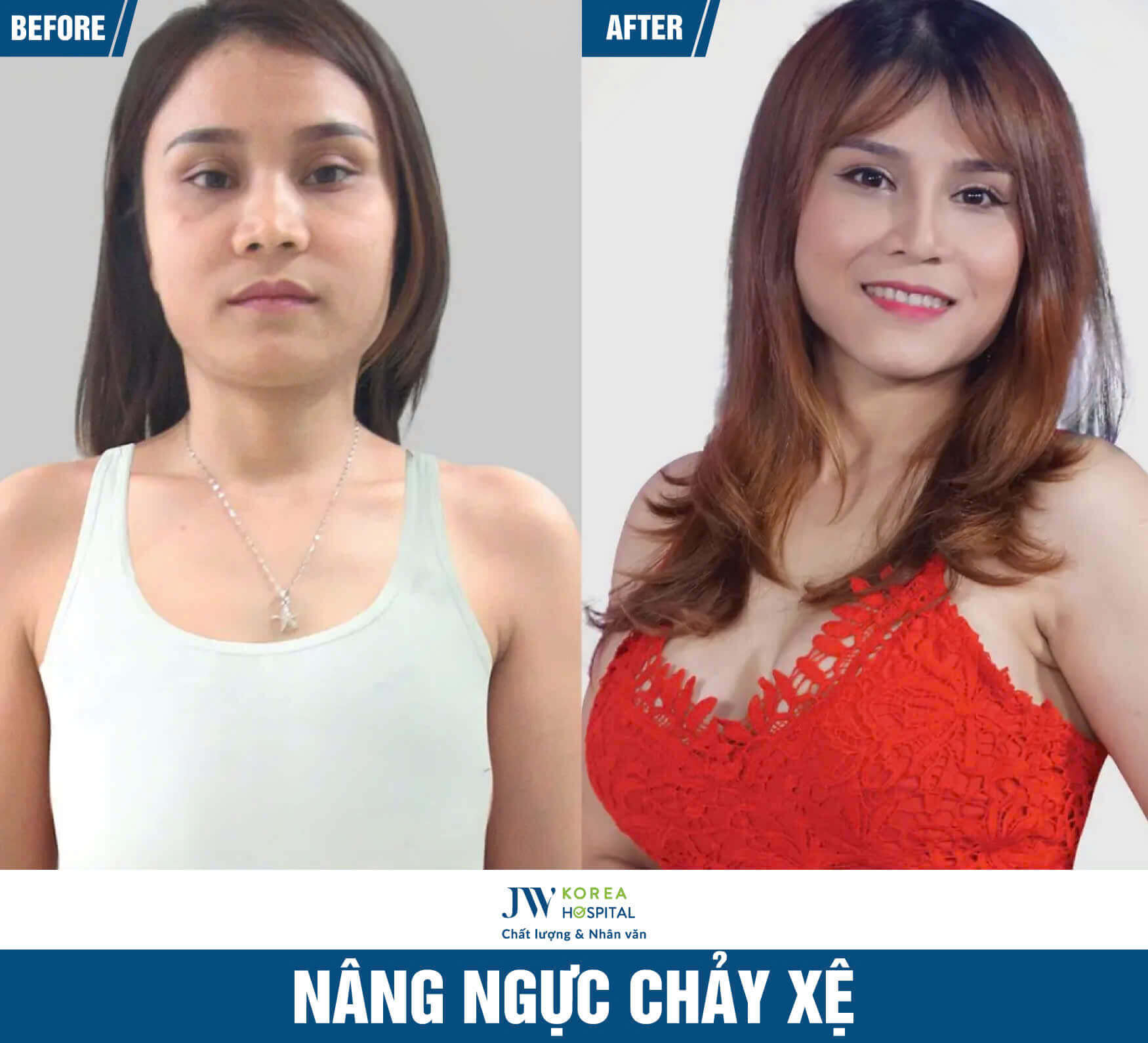 nang nguc chay xe
