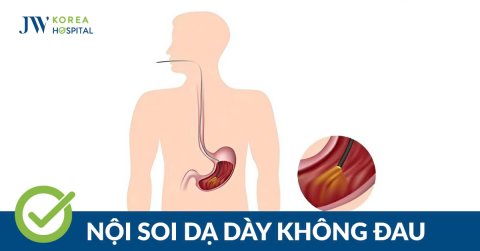 Nội soi dạ dày không đau: Giải pháp nhẹ nhàng giúp phát hiện bệnh lý sớm