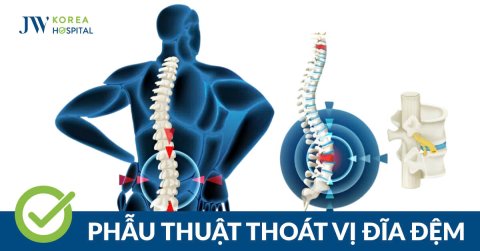 Phẫu thuật thoát vị đĩa đệm: Làm gì để phục hồi, tránh tái phát?
