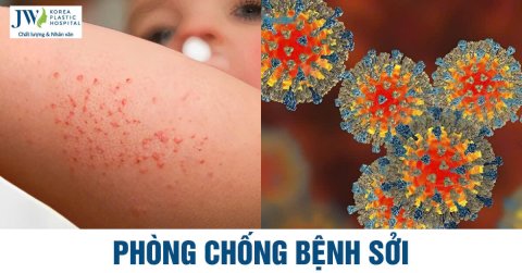 Phòng chống bệnh sởi và lợi ích tiêm phòng vắc xin sởi