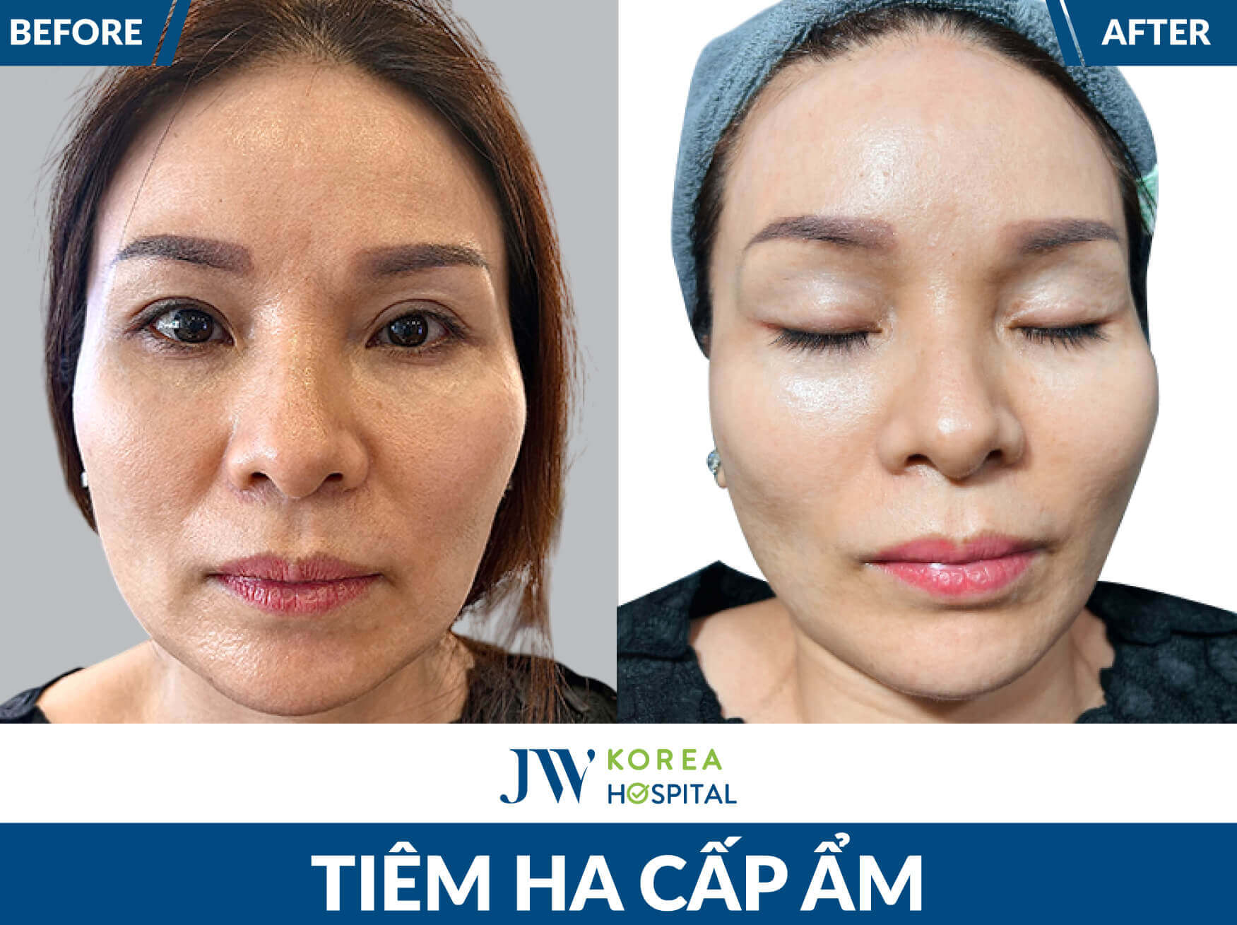 tiem-ha