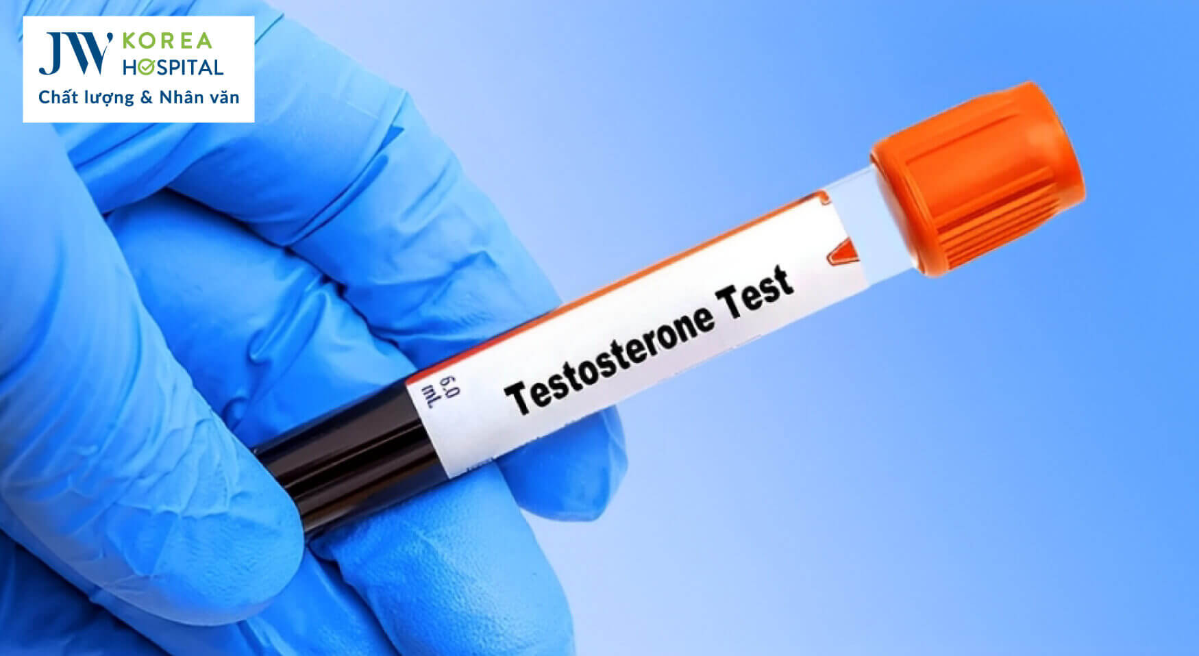 xet nghiem testosterone