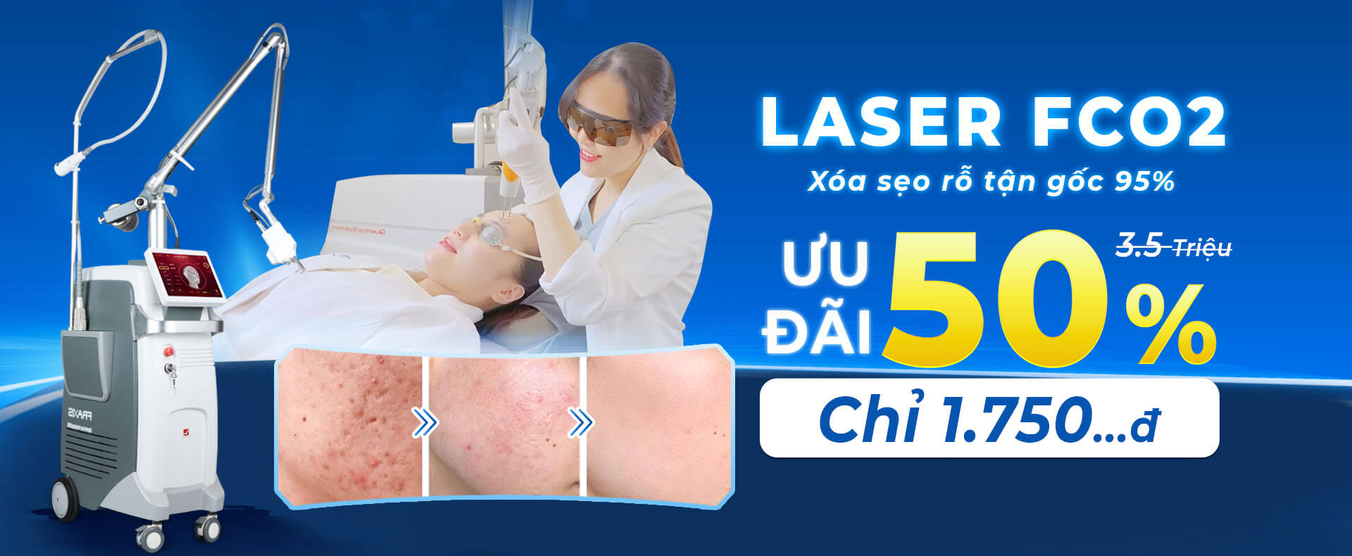 laser-seo