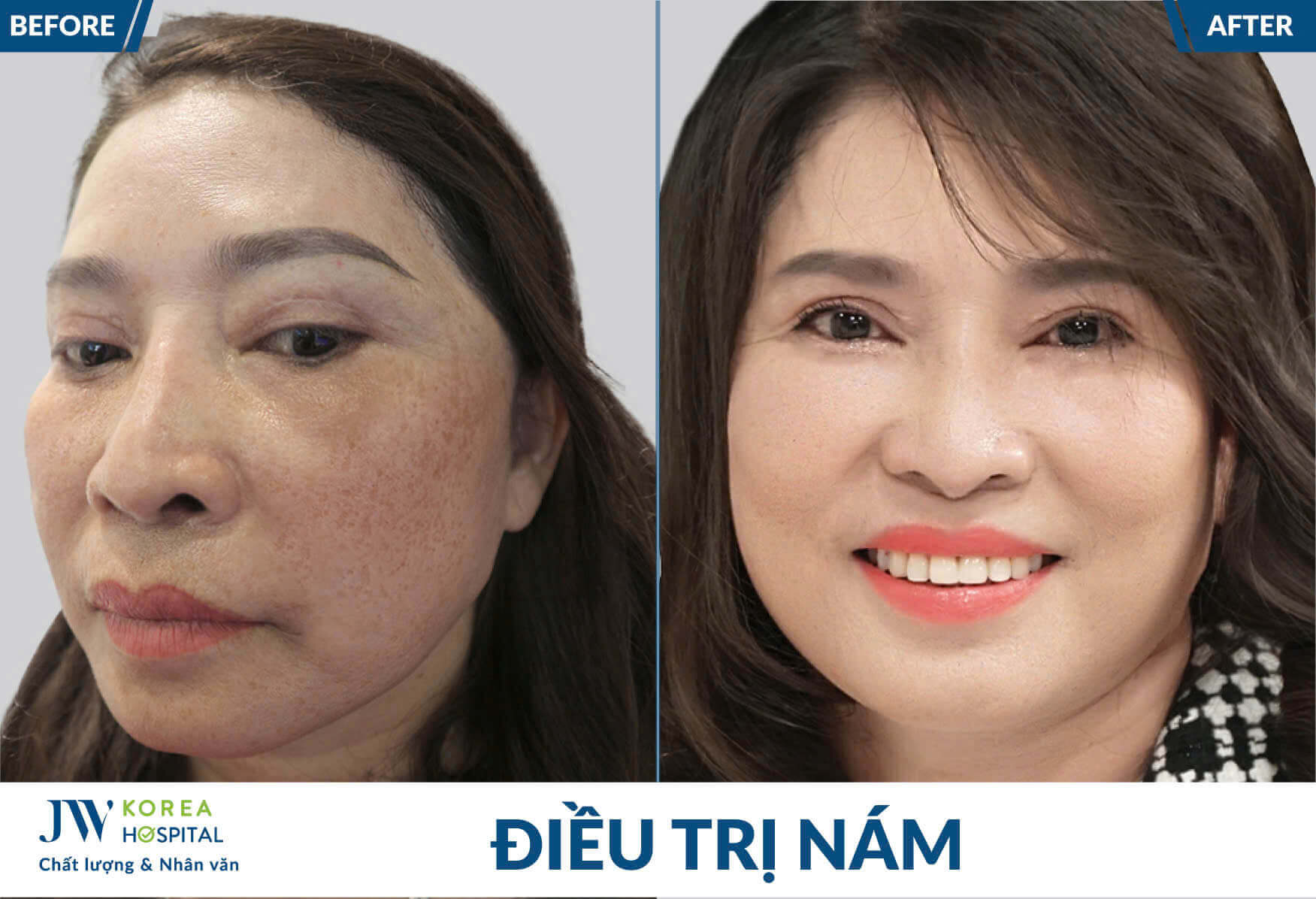 dieu-tri-nam