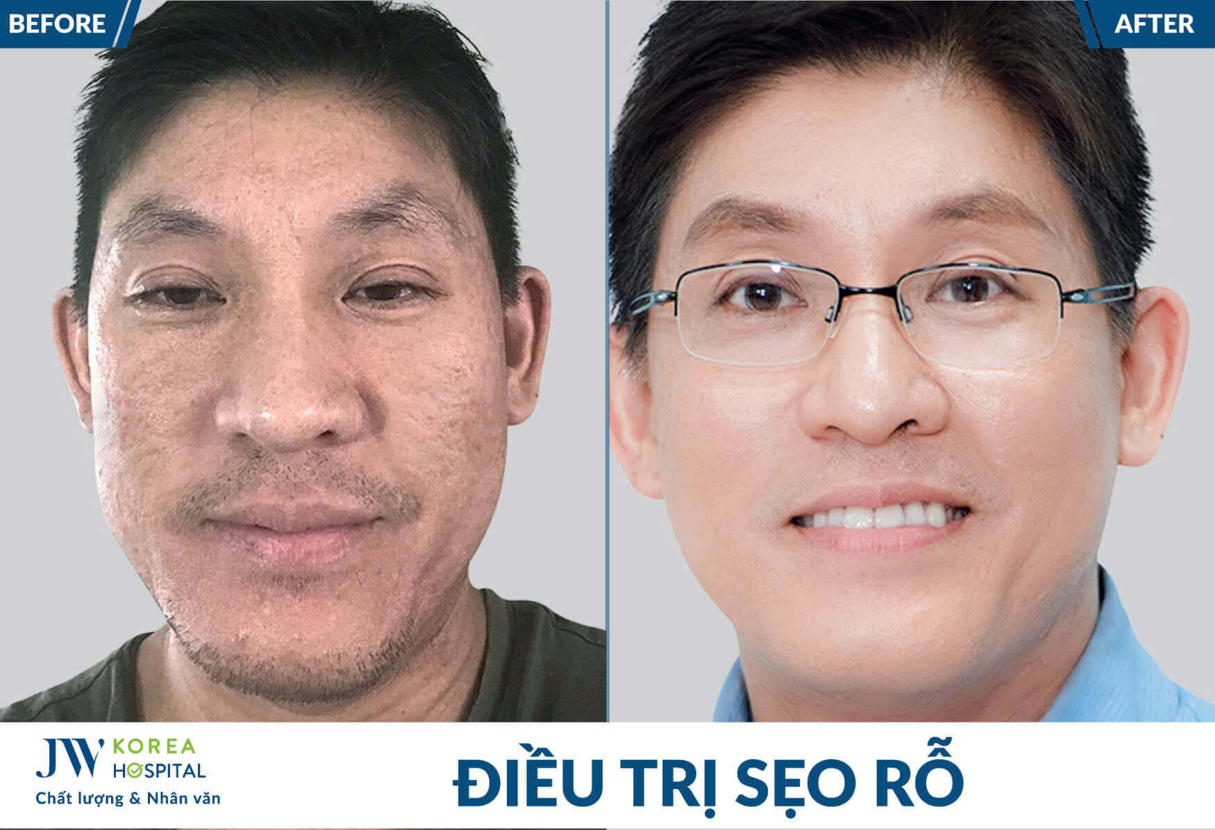 dieu-tri-seo
