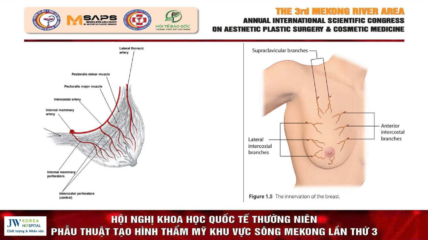 nguc-sa-tre