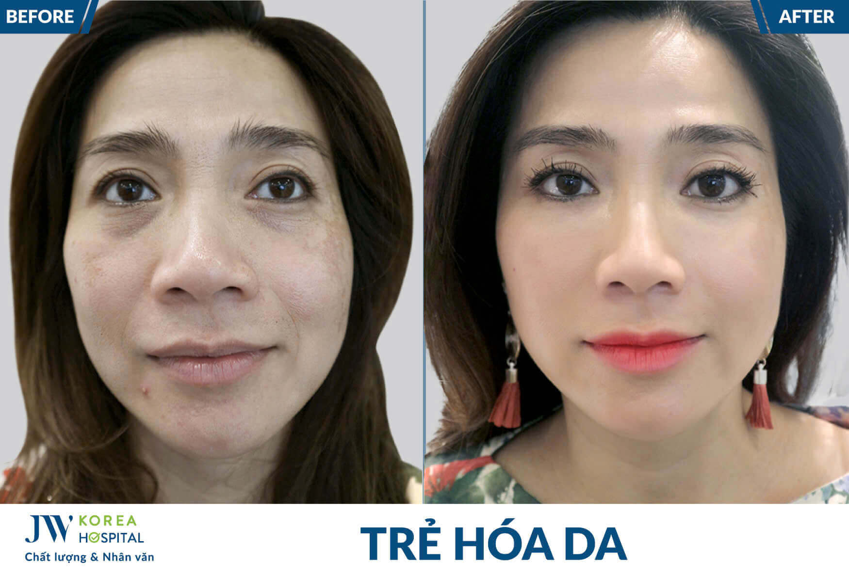 tre-hoa-da